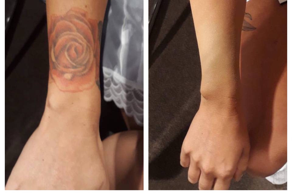 Tattoo coverup