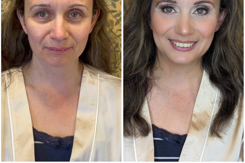 Brightening and lifting