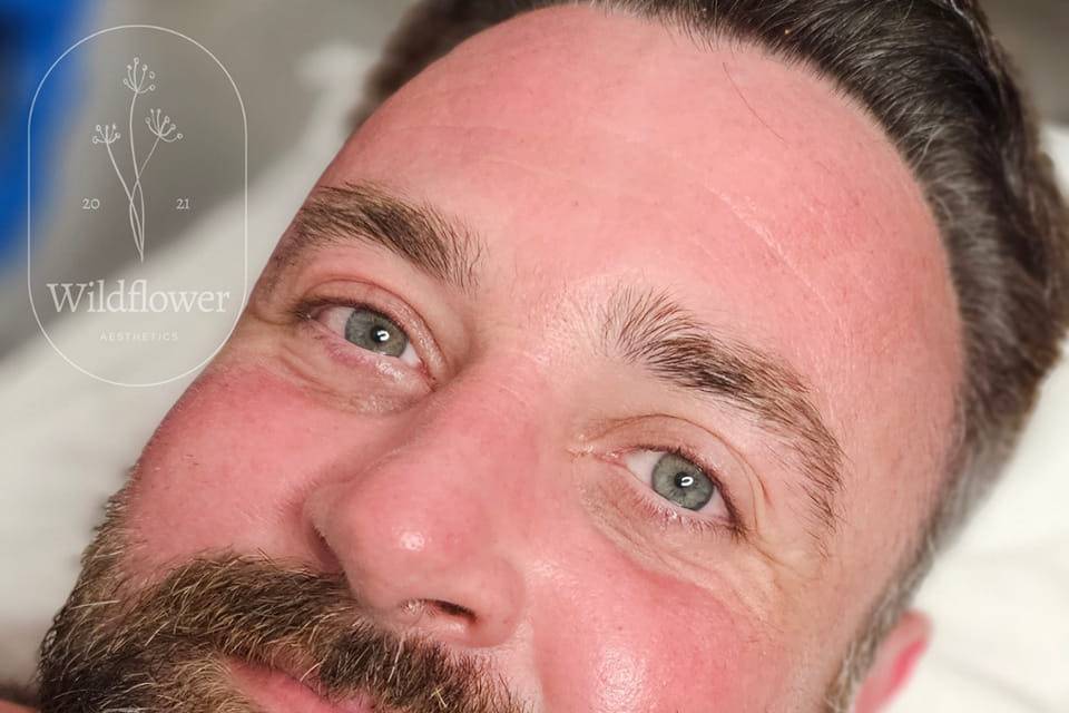 Vitamin Glow Facial.