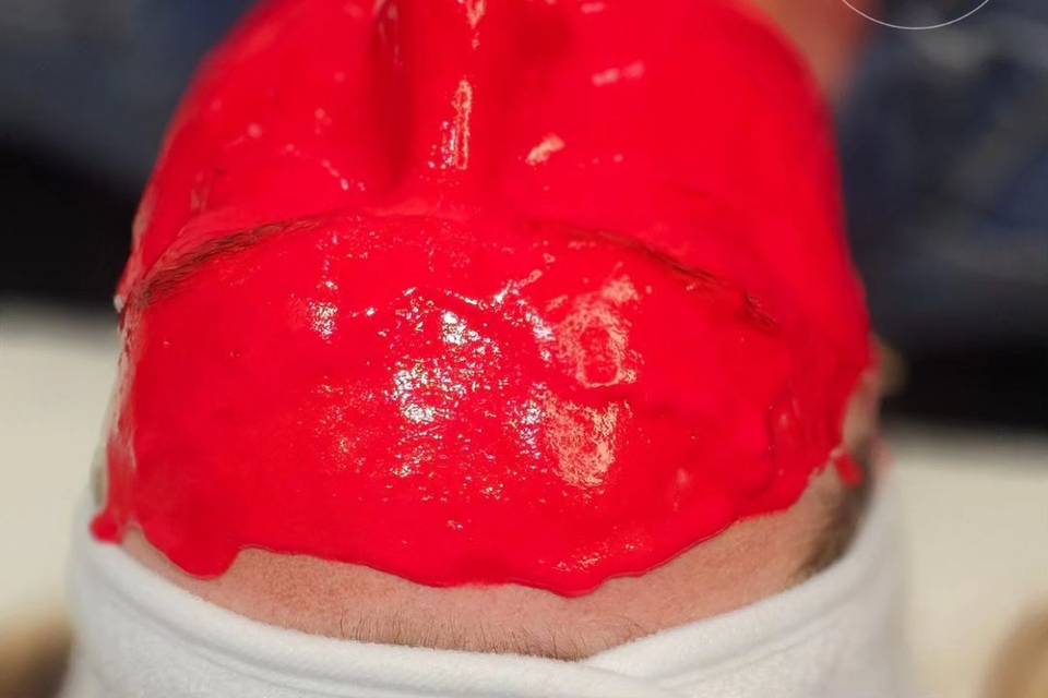 Hyrdo-Jelly Facial.