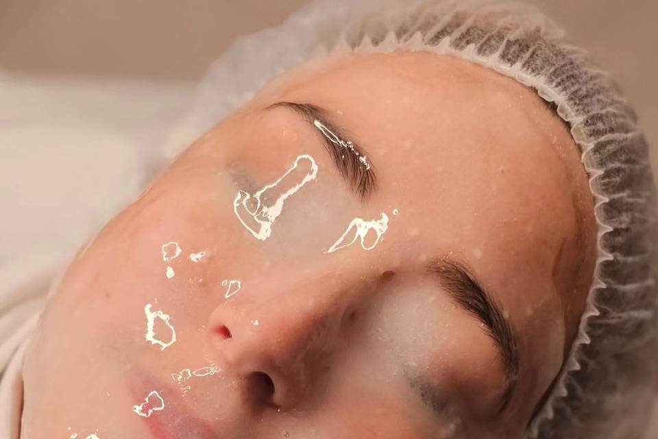 Hyrdo-Jelly Facial.