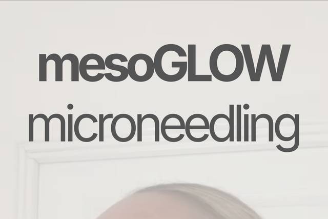 Mesoglow microneedling