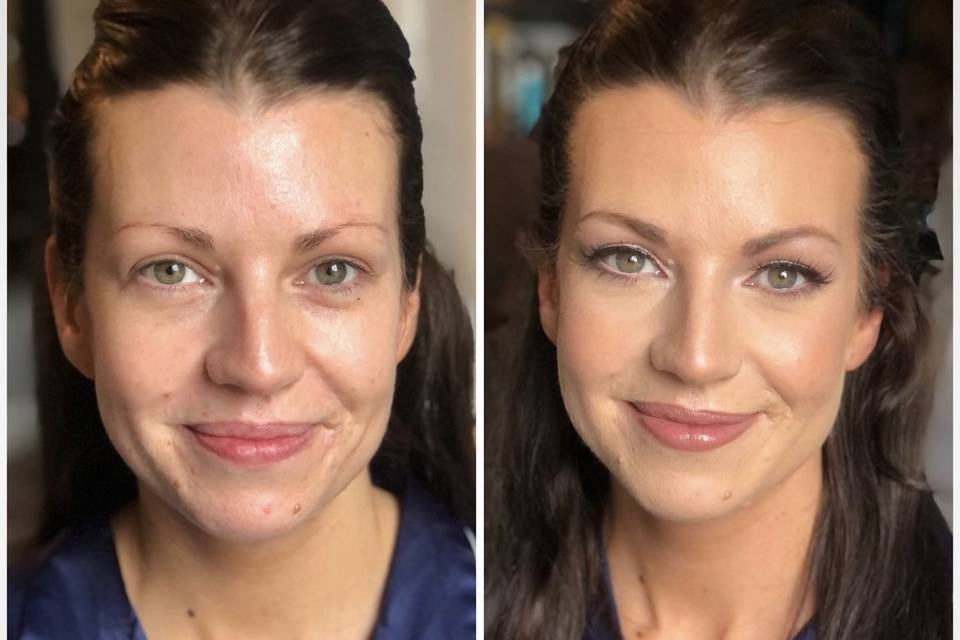 Before & after Natural Glow