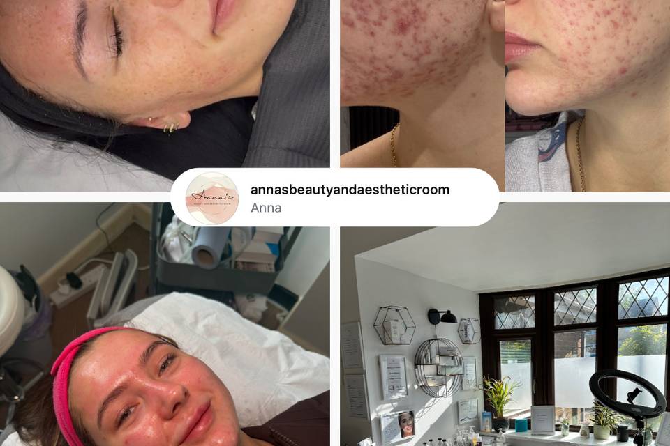 Anna’s Beauty and Aesthetic Room