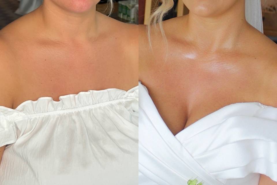 Before and after