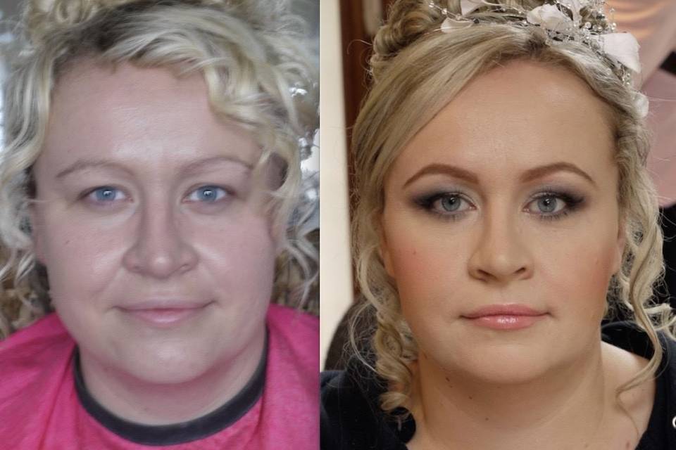 Before and after