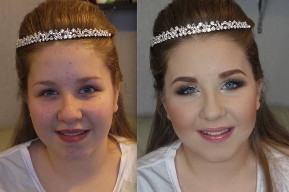 Before and after