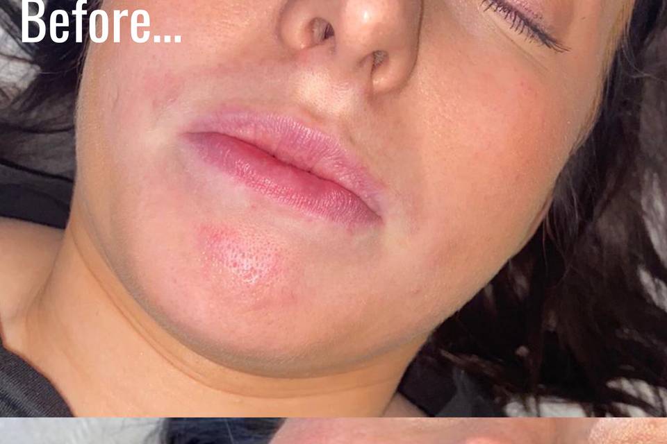 Lip blush before and after