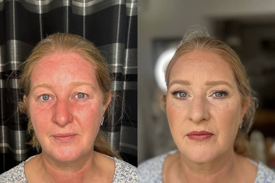 Before vs After ✨