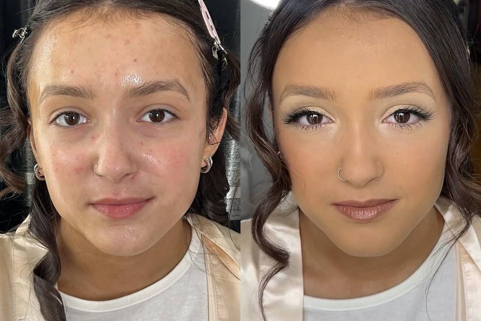 Before and After 🤍
