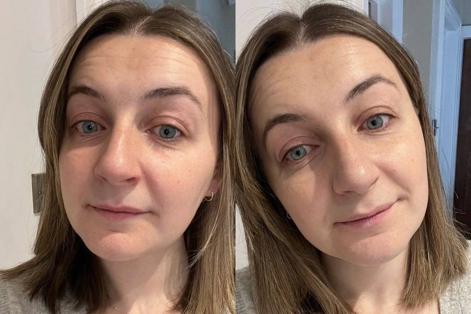 Chloe's client before & after