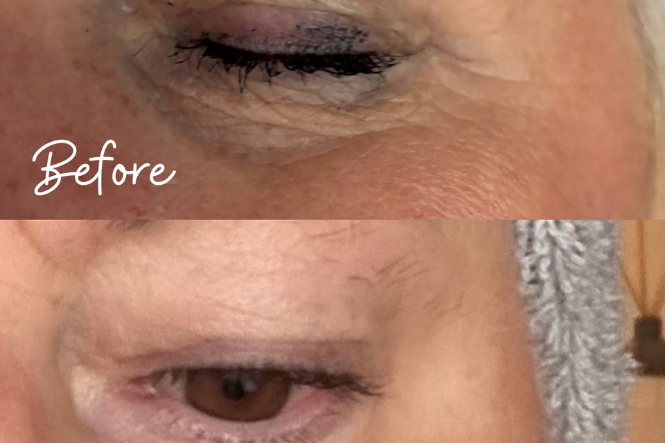 Chloe's client before & after