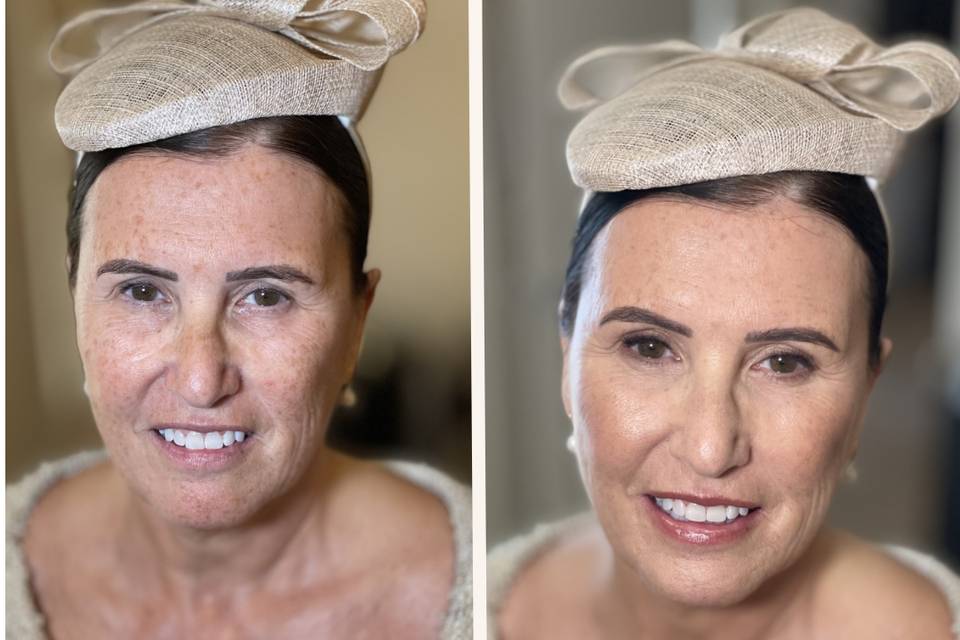 Before & after
